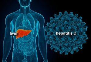 Hepatitis_C_Virus